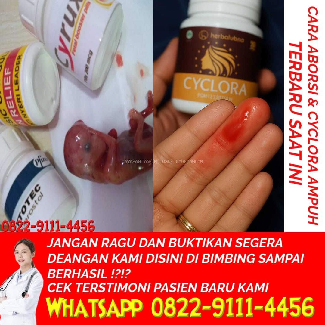 Cytotec 400 mg: Ampuh, Dosis Tinggi, Aturan Pakai, dan Efek Samping 082291114456